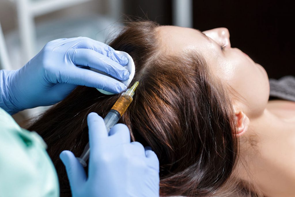 Is it better to treat hair loss with mesotherapy or PRP