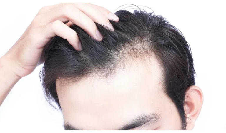  ۵ روش برای تقویت موهای آسیب دیده از سشوار