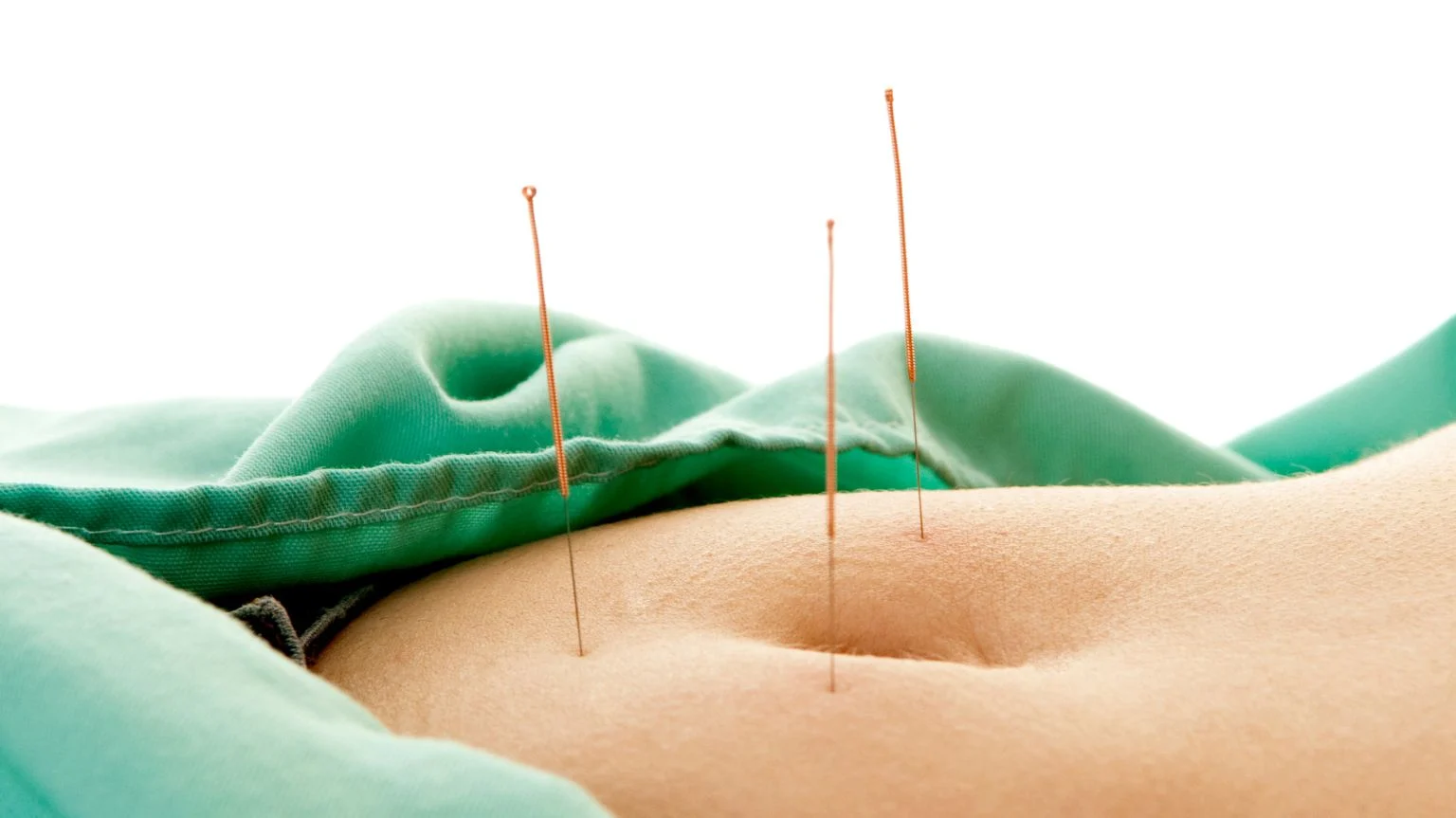 طب سوزنی و لاغری