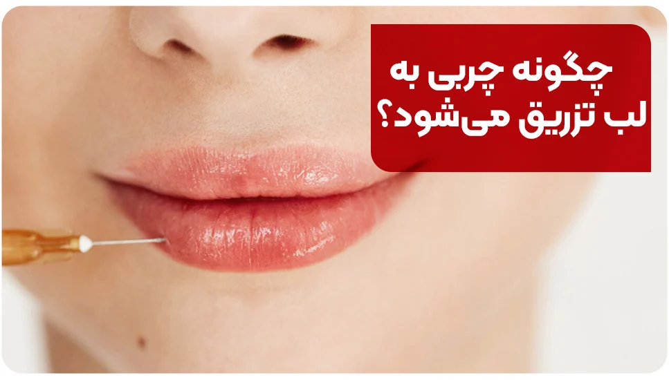 چگونه چربی به لب تزریق میشود؟