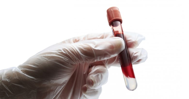 چگونه با کمک راهکارهای طب سنتی غلظت خون را کاهش دهیم؟