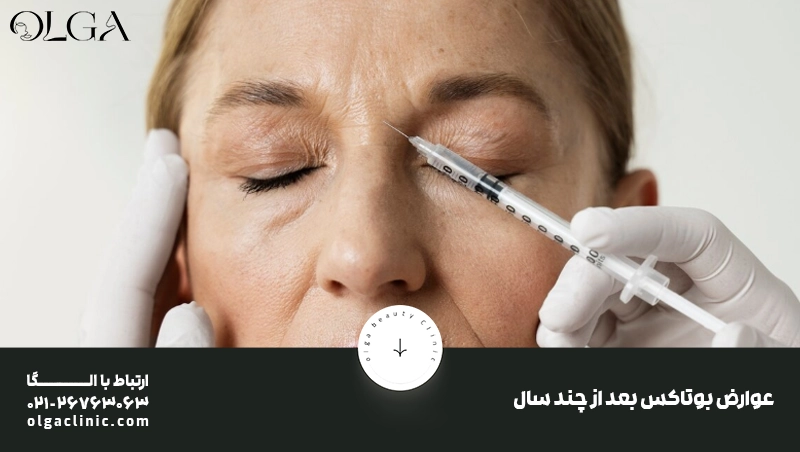 عوارض بوتاکس بعد از چند سال